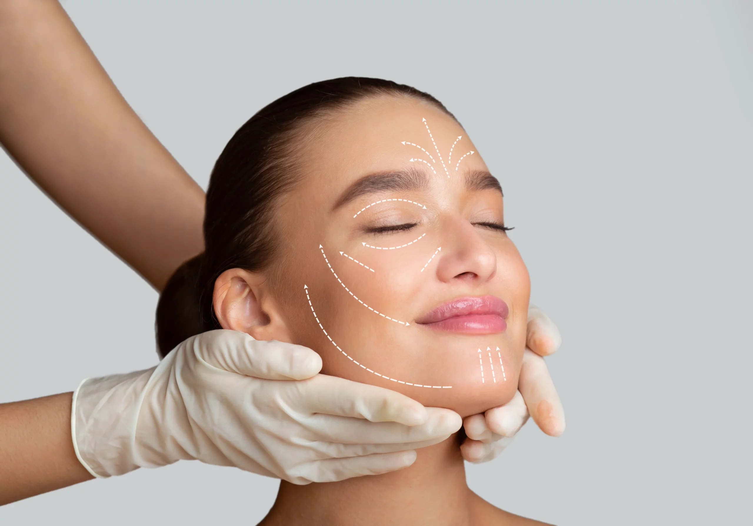 Sculptra Treatment by Canvas Med Spa in Mount Kisco NY