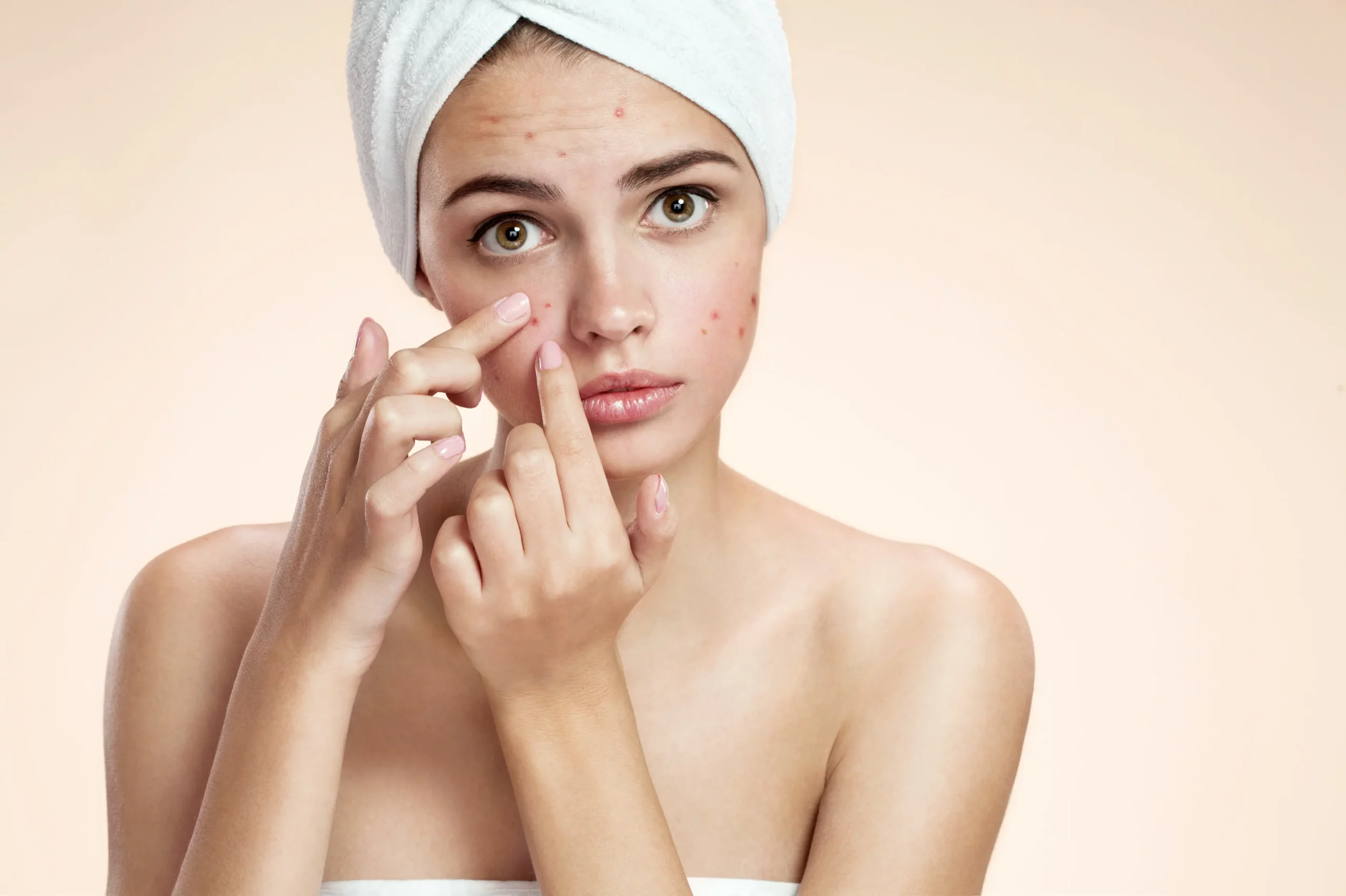 Acne and Acne Scars Treatment by Canvas Med Spa in Mount Kisco NY