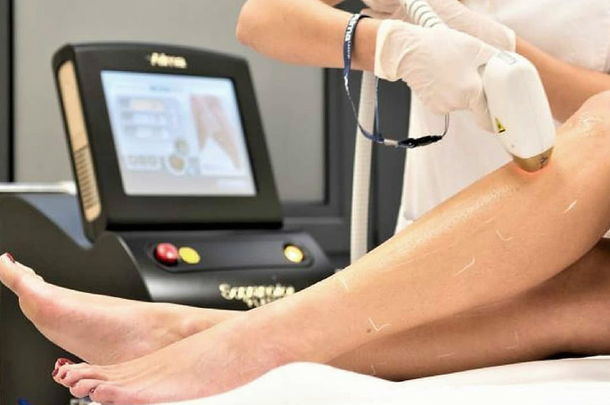 Laser Hair Removal Treatment by Canvas Medical Spa in Mount Kisco NY