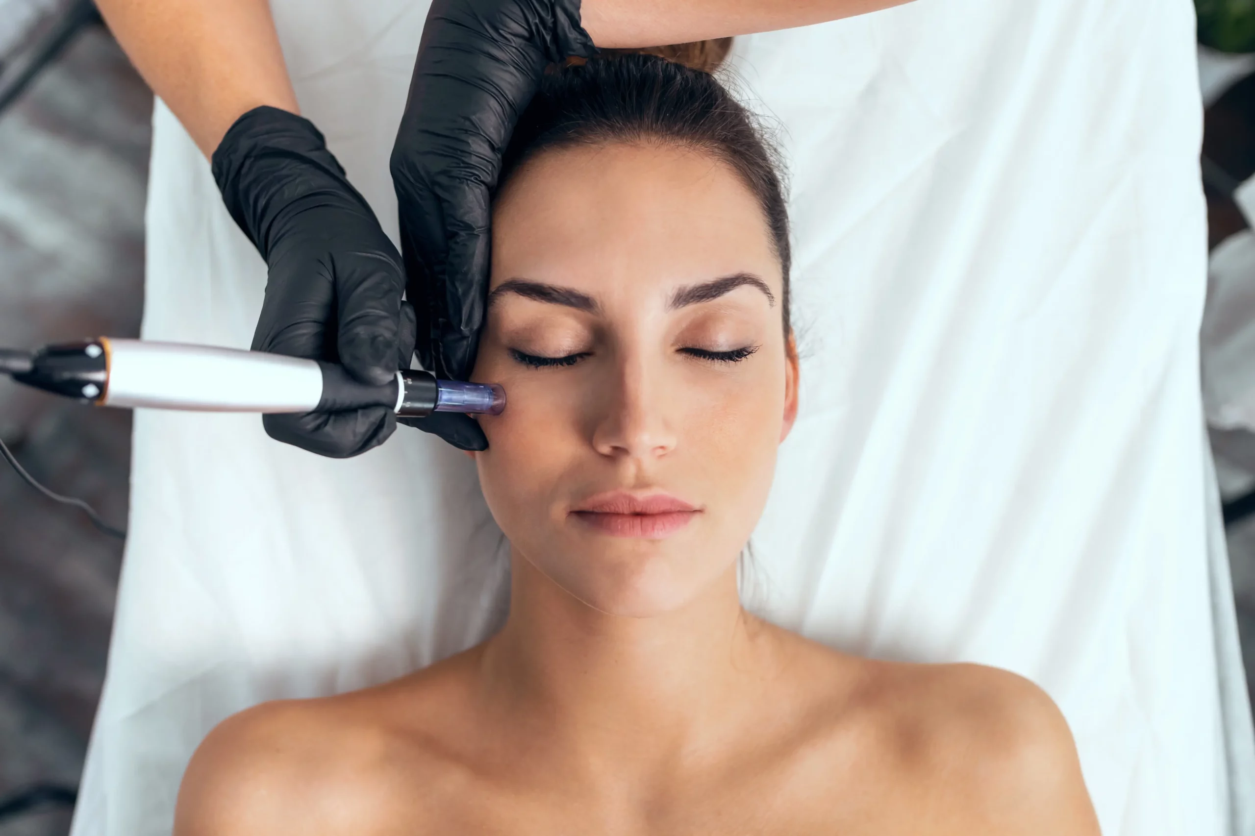 Microneedling Treatment by Canvas Medical Spa in Mount Kisco NY